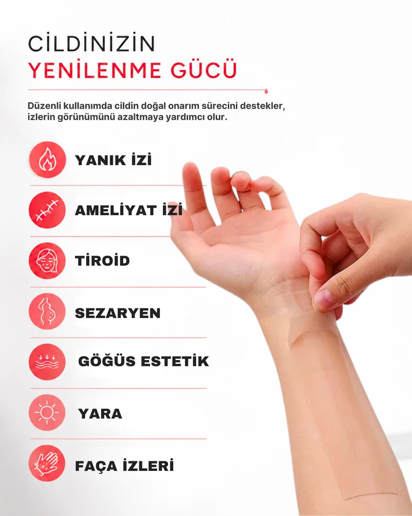 İz Giderici Bant