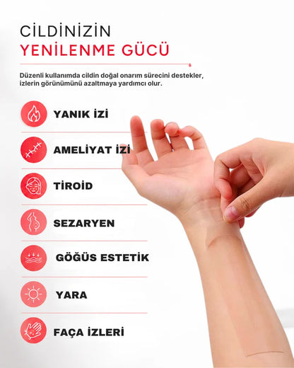 İz Giderici Bant