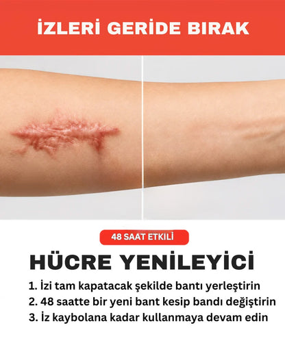 İz Giderici Bant